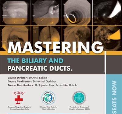 Mastering The Biliary And Pancreatic Ducts